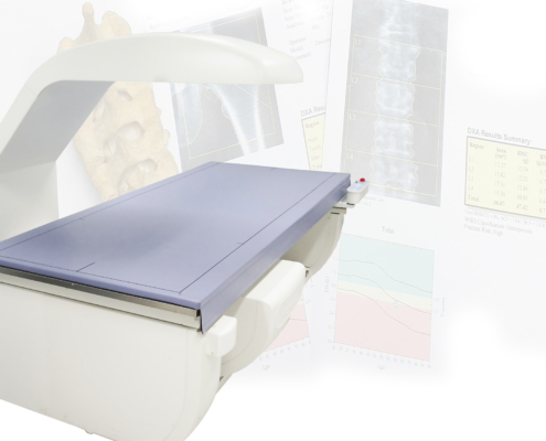 Close up Bone densitometry machine .Surface blurry image